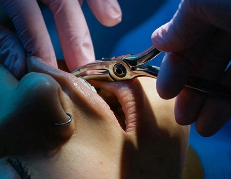 SLM Metal 3D Printer - 24